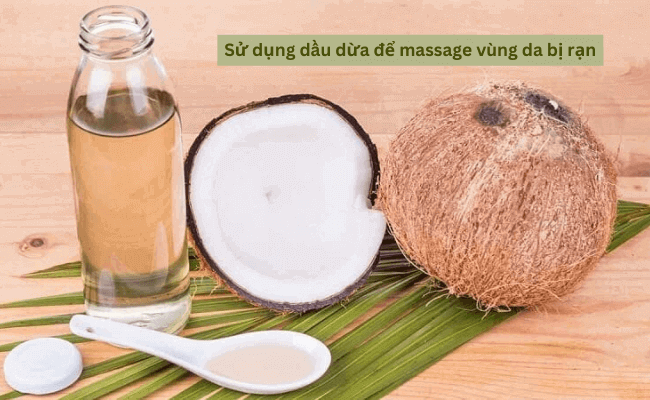 trị rạn da sau sinh bằng dầu dừa