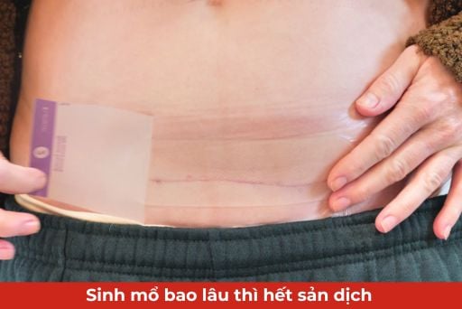 sinh mổ bao lâu thì hết sản dịch thumb
