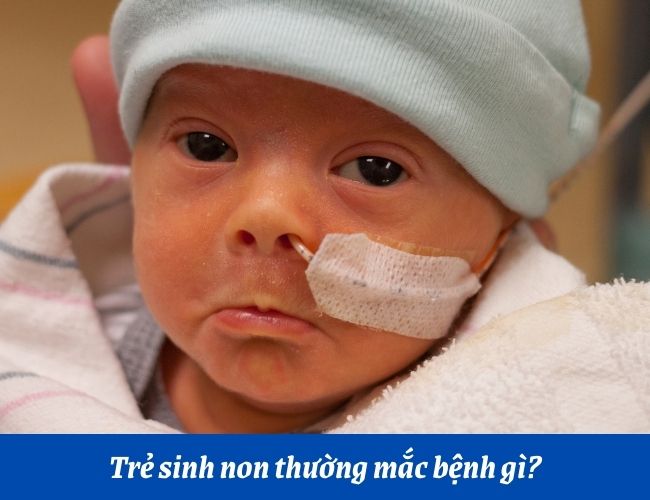 rẻ sinh non thường gặp các vấn đề về thân nhiệt và hệ tiêu hóa