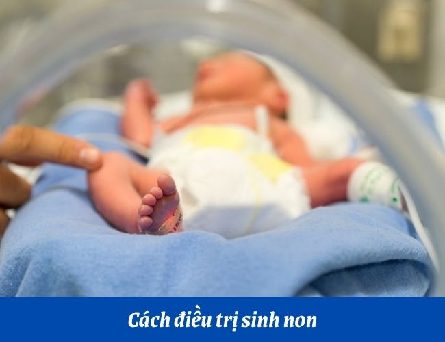 Hầu hết ca sinh non đều được chăm sóc tích cực