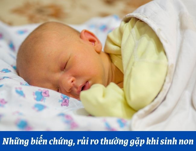 Vàng da là một trong những biến chứng thường thấy ở trẻ sinh non