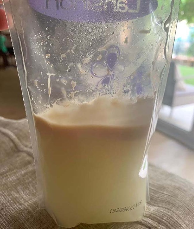 sữa mẹ bị nổi váng