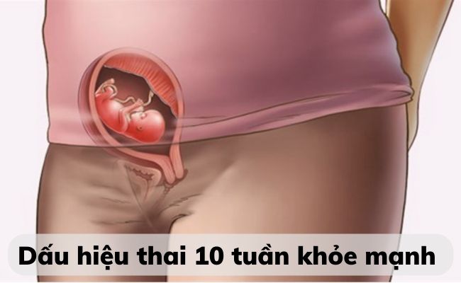Thai nhi tuần 10 phát triển như thế nào? Dấu hiệu thai 10 tuần khỏe mạnh
