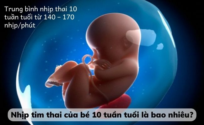 Nhịp tim thai của bé 10 tuần tuổi vẫn còn rất nhẹ, mẹ chưa thể nghe trực tiếp được