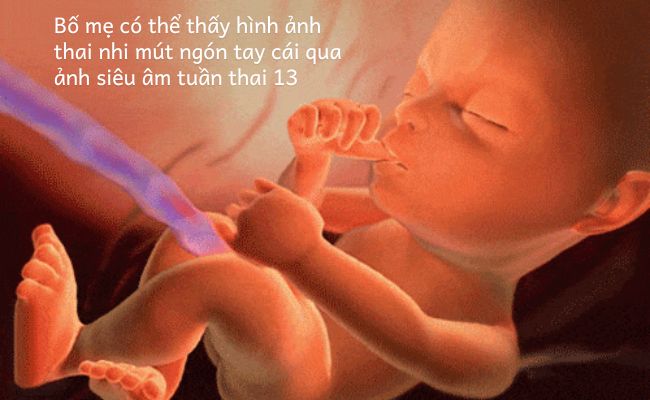 Hình ảnh thai nhi 13 tuần mút ngón tay cái qua siêu âm