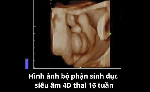 Hình ảnh bộ phận sinh dục siêu âm 4D thai 16 tuần