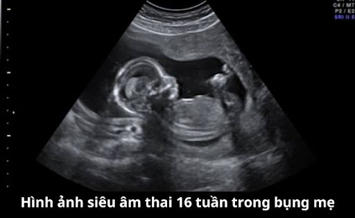 Hình ảnh siêu âm thai 16 tuần trong bụng mẹ
