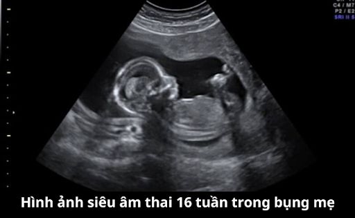 Hình ảnh thai nhi 16 tuần trong bụng mẹ