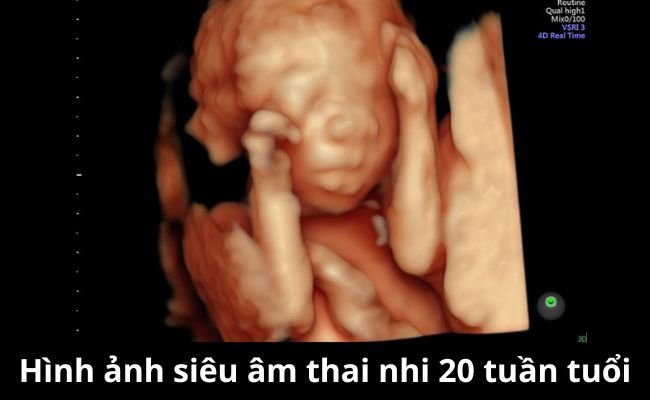 Hình ảnh thai nhi 20 tuần