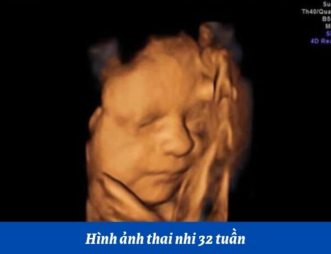 Thai nhi 32 tuần trong bụng mẹ