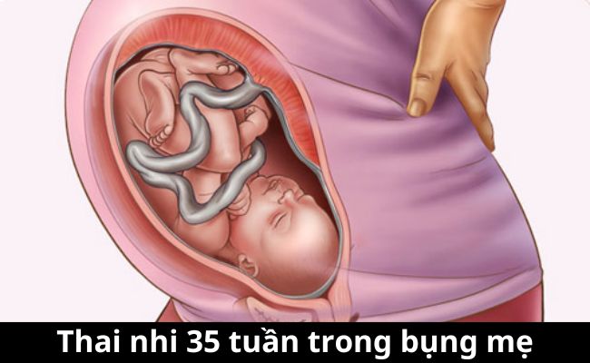 Thai nhi 35 tuần trong bụng mẹ