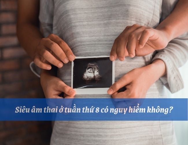 Mẹ chỉ nên siêu âm theo định kỳ