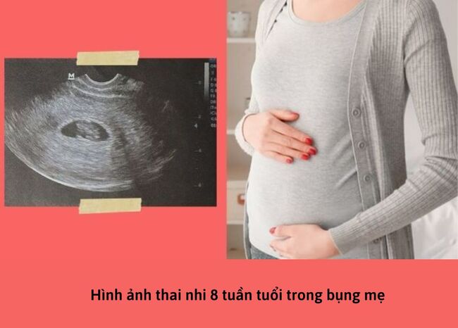 Hình ảnh thai nhi 8 tuần tuổi trong bụng mẹ