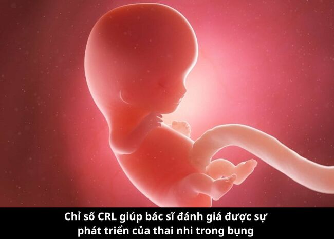 Chỉ số CRL giúp bác sĩ đánh giá được sự phát triển của thai nhi trong bụng