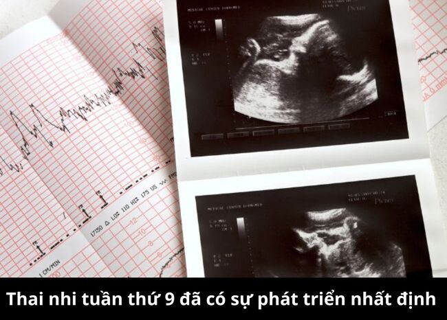 Thai nhi tuần thứ 9 đã có sự phát triển nhất định