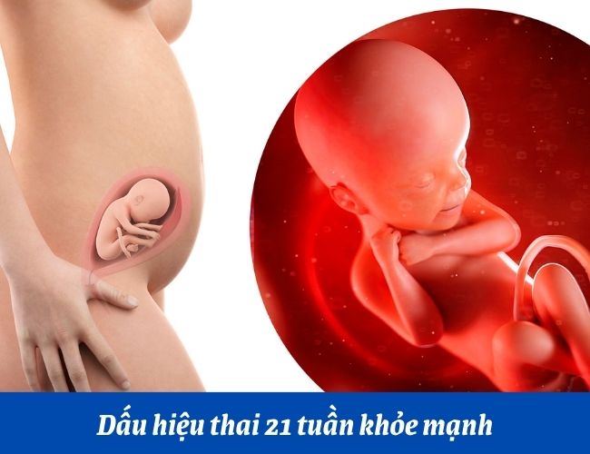 Dấu hiệu thai 21 tuần khỏe mạnh