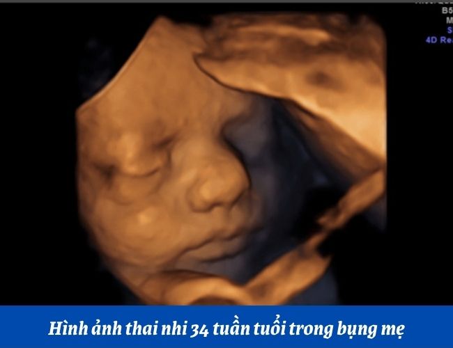 Hình ảnh thai nhi 34 tuần tuổi trong bụng mẹ