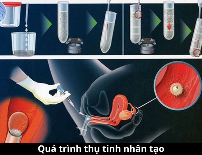 Quá trình thụ tinh nhân tạo