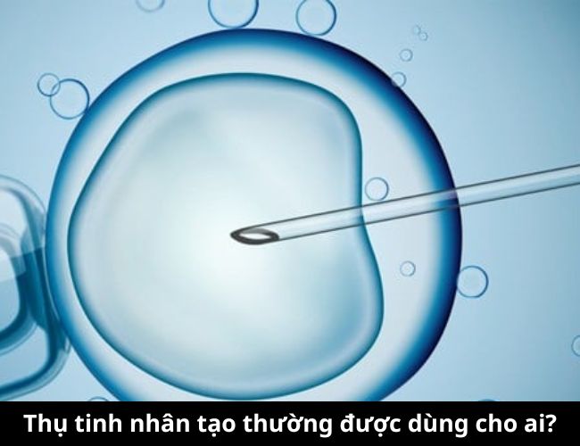 Những trường hợp nên sử dụng phương pháp thụ tinh nhân tạo