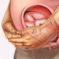 sự phát triển của thai nhi tuần thứ 22