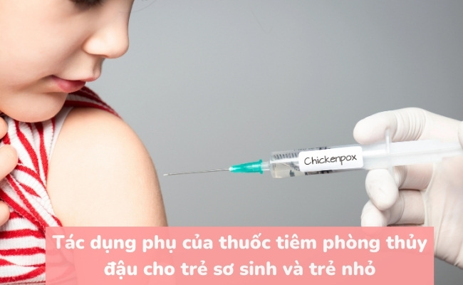 Tác dụng phụ của thuốc tiêm phòng thủy đậu cho trẻ sơ sinh và trẻ nhỏ