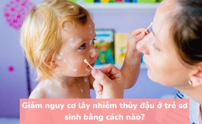 Giảm nguy cơ lây nhiễm thủy đậu ở trẻ sơ sinh bằng cách nào