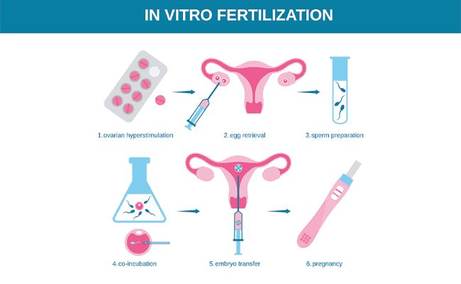 Kích trứng trong thụ tinh ống nghiệm IVF cho đối tượng nào