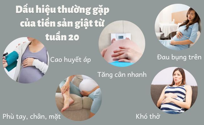 Dấu hiệu dễ nhận thấy từ tuần 20 của tiền sản giật ở thai phụ