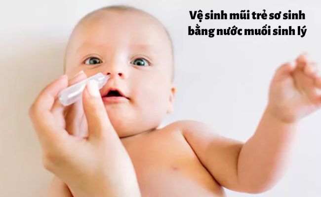 Vệ sinh mũi sạch sẽ và đúng cách là điều đầu tiên bố mẹ nên làm khi trẻ sơ sinh nghẹt mũi