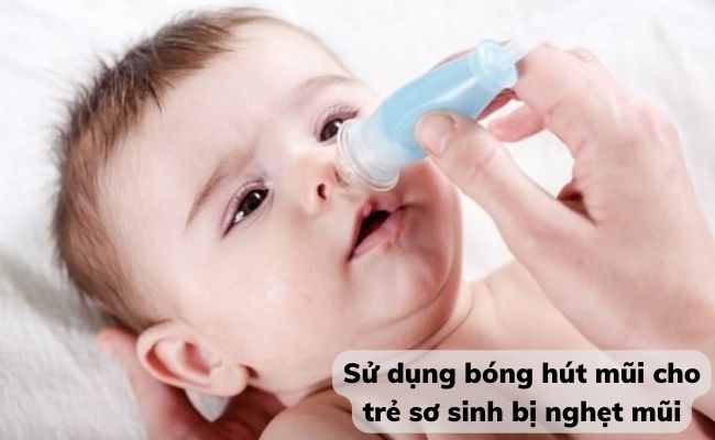 Sử dụng bóng hút mũi cho trẻ sơ sinh