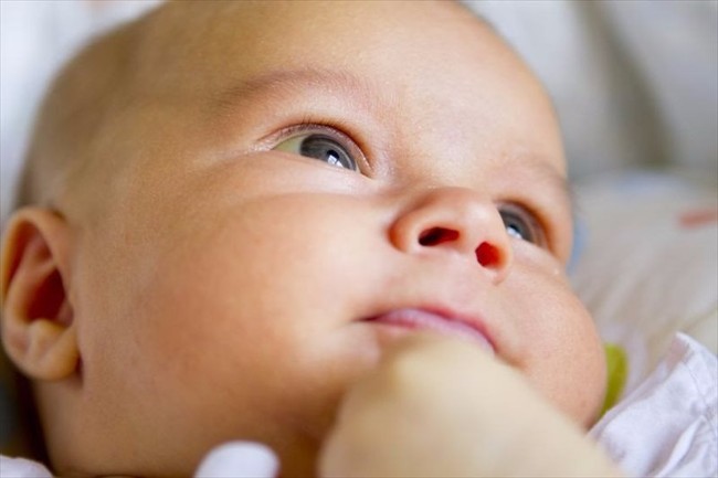 Phân biệt trẻ sơ sinh bị vàng da vàng mắt sinh lý và bệnh lý 
