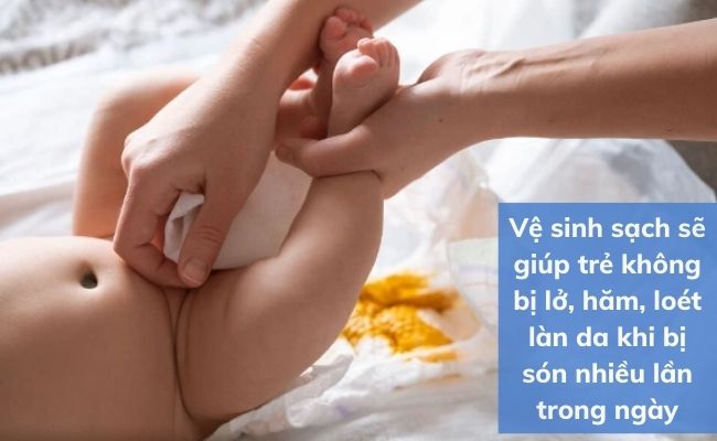 Vệ sinh làn da cho trẻ cẩn thận và sạch sẽ khi trẻ bị són phân liên tục trong ngày