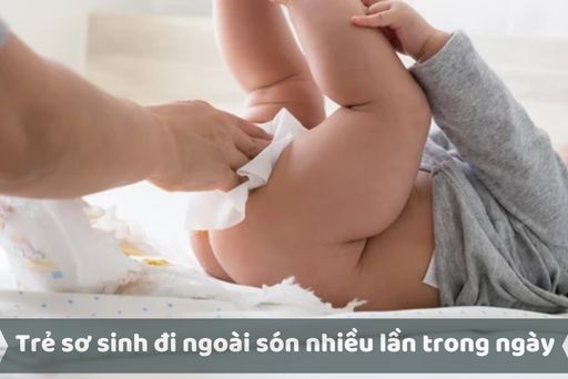 Cách Đi Cầu  Đại Tiện  Không Hôi Cực Hay  Hướng Dẫn Mẹo Đi ỈA  Vệ Sinh   Không Bao Giờ Hôi  YouTube
