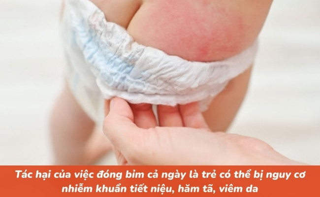 Tác hại của việc đóng bỉm cả ngày