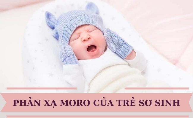 Trẻ sơ sinh ngủ hay giật mình: Nguyên nhân và cách cải thiện