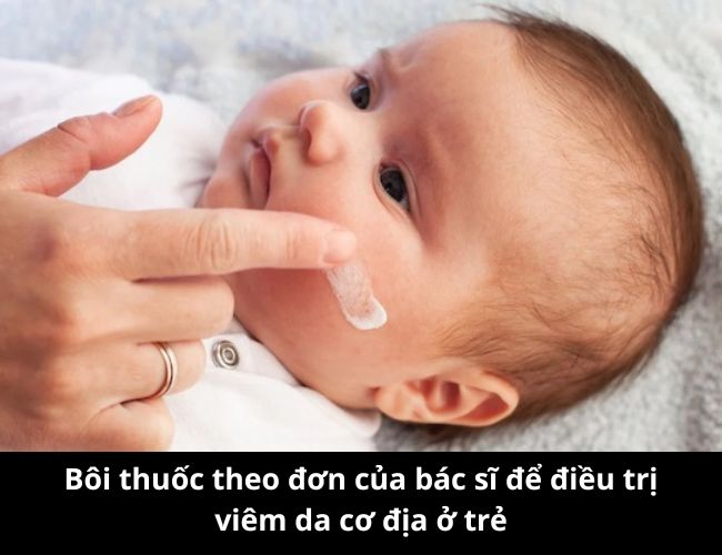 Bôi thuốc theo đơn của bác sĩ để điều trị viêm da cơ địa ở trẻ