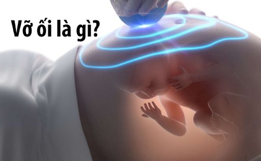 Vỡ ối là gì?