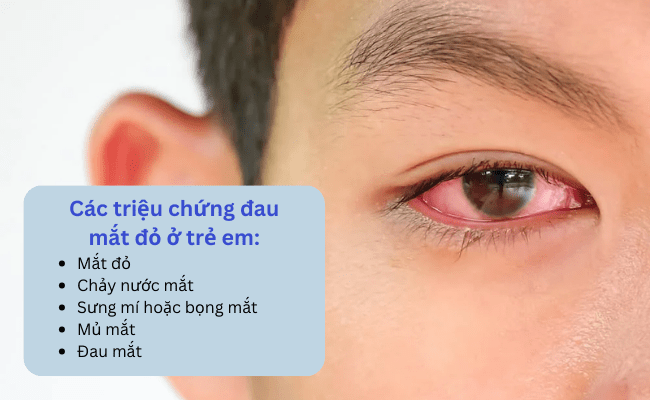 Các triệu chứng đau mắt đỏ ở trẻ em