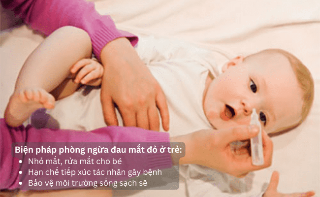 Một số biện pháp phòng ngừa đau mắt đỏ ở trẻ mà bố mẹ có thể thực hiện